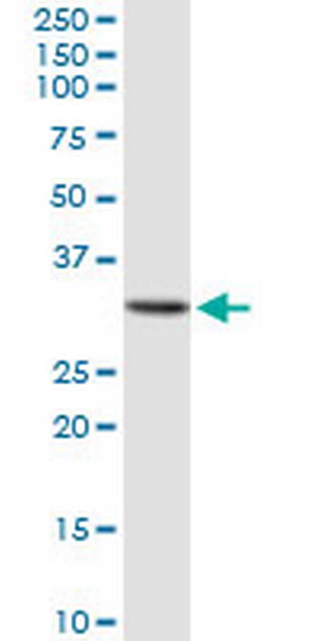 GALNT12 Antibody in Western Blot (WB)