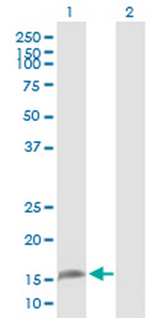 ZMAT4 Antibody in Western Blot (WB)