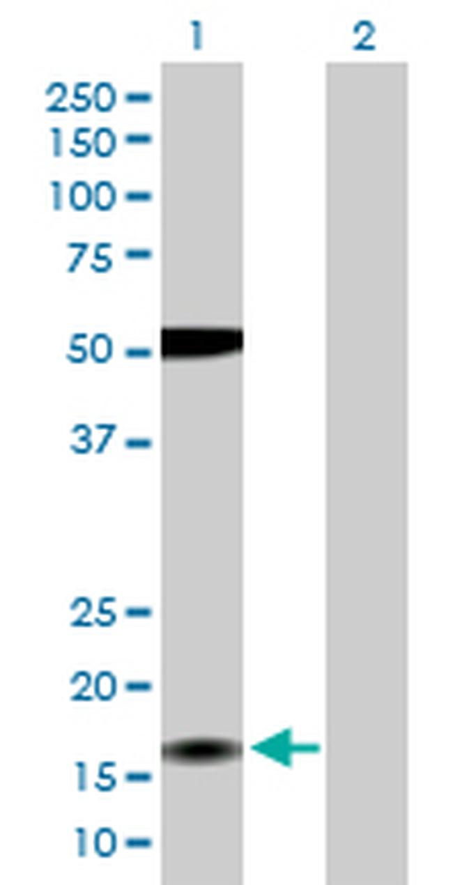 ZMAT4 Antibody in Western Blot (WB)