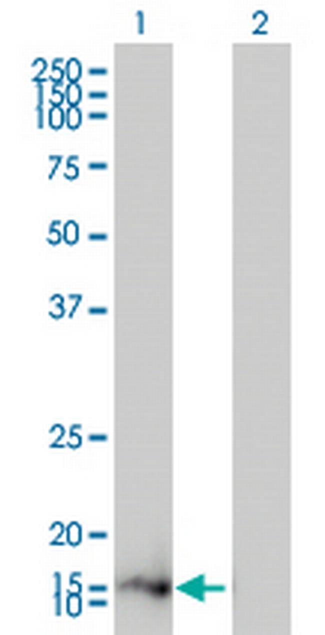 ZMAT4 Antibody in Western Blot (WB)