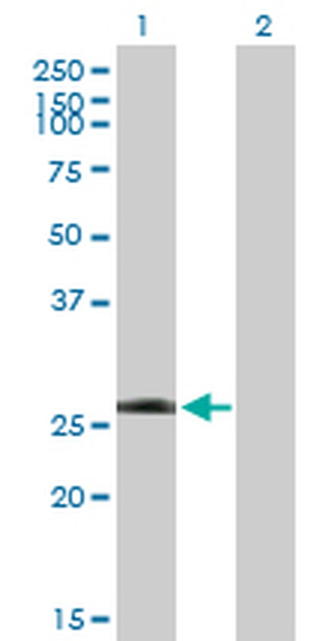 LRRK1 Antibody in Western Blot (WB)