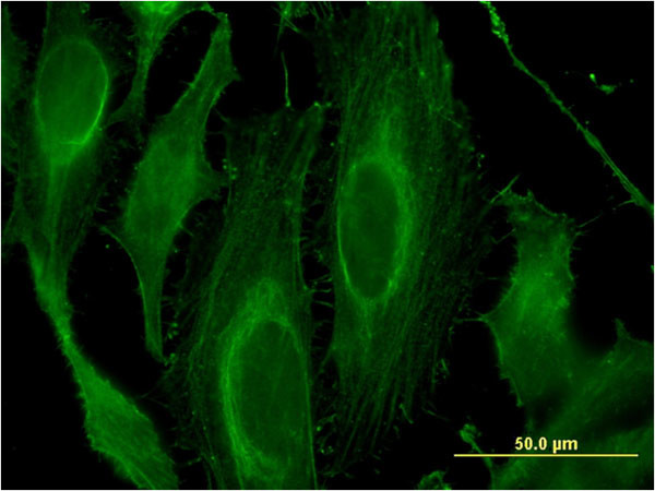 LRRK1 Antibody in Immunocytochemistry (ICC/IF)