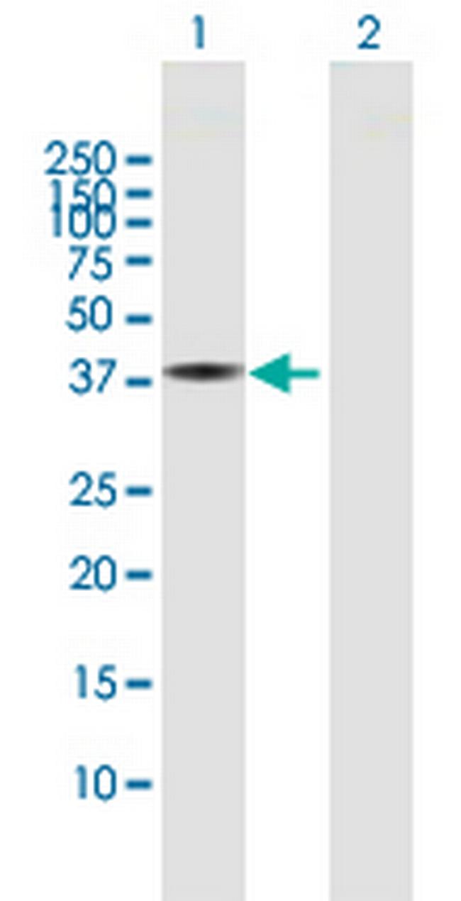 FLJ11506 Antibody in Western Blot (WB)