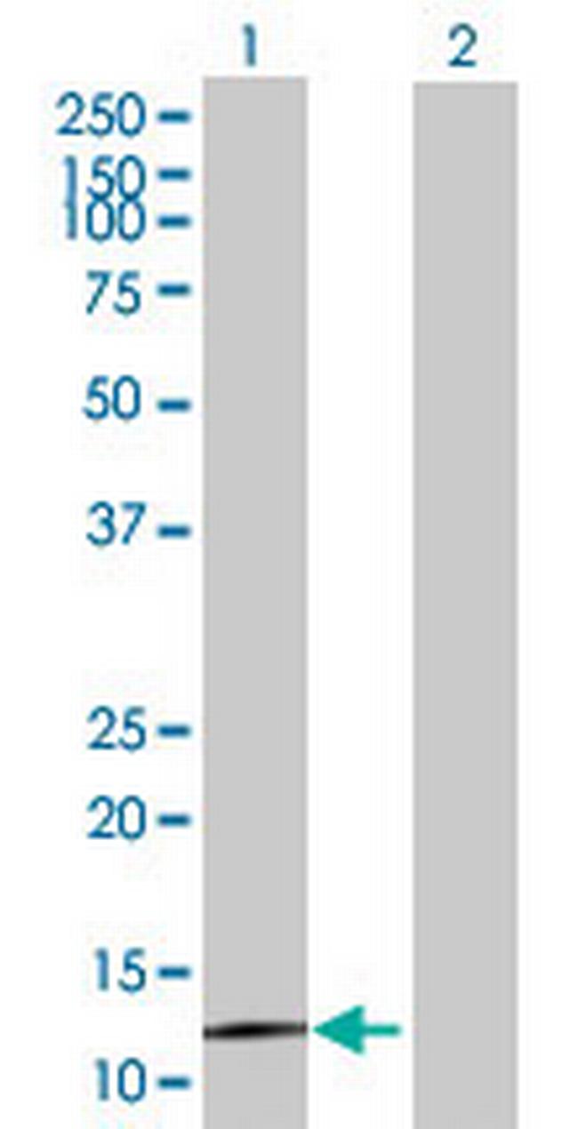 FLJ23560 Antibody in Western Blot (WB)