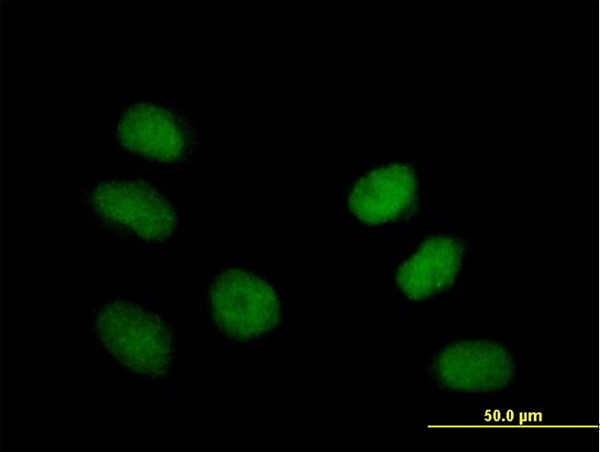 ZNF659 Antibody in Immunocytochemistry (ICC/IF)