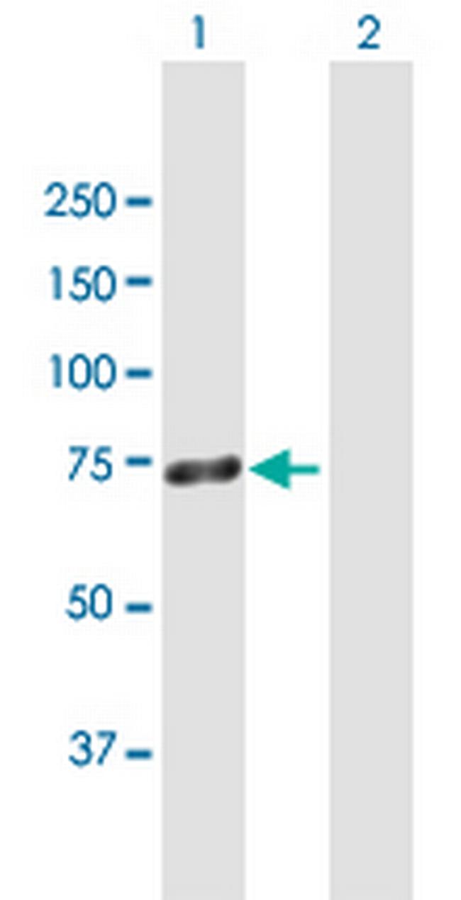 ZNF668 Antibody in Western Blot (WB)