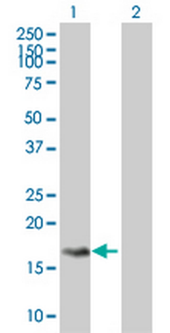 GEMIN7 Antibody in Western Blot (WB)