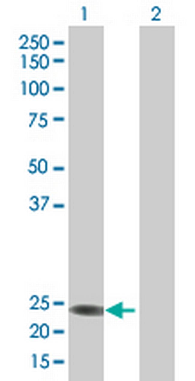 FLJ22655 Antibody in Western Blot (WB)