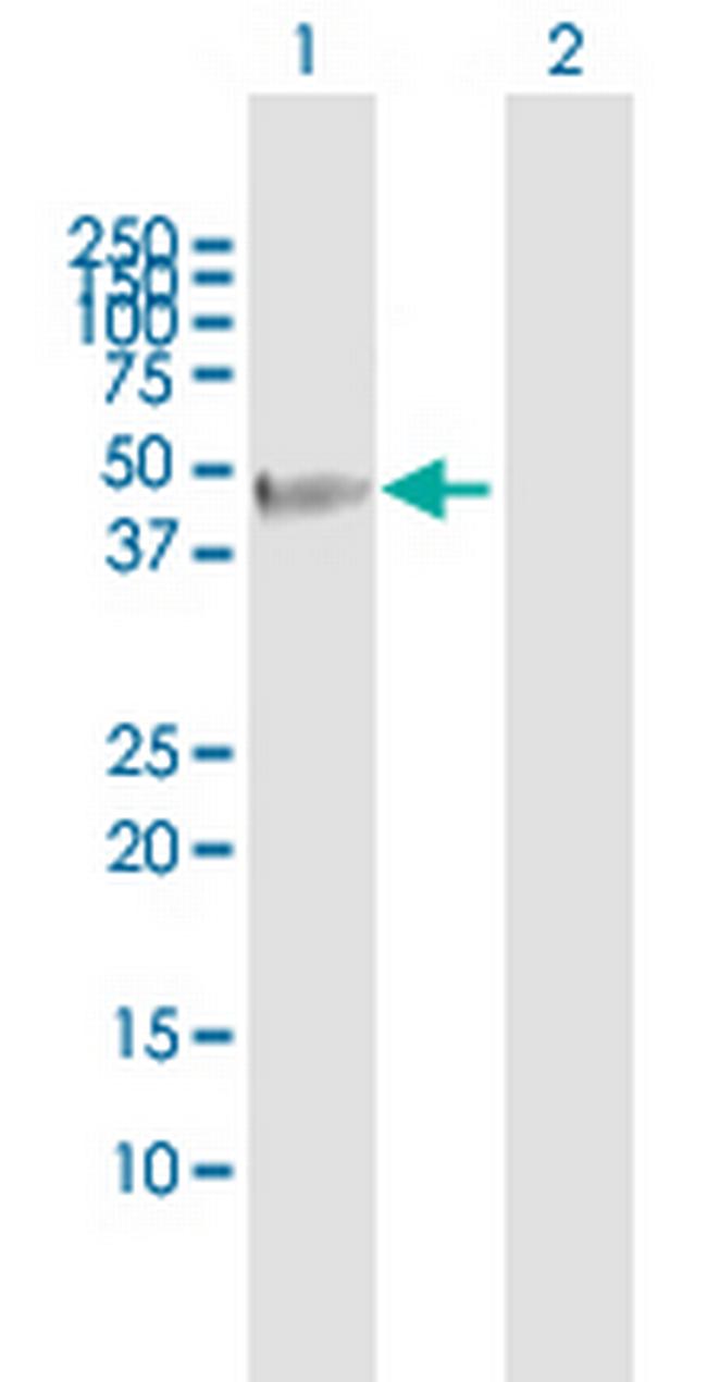 FBXO31 Antibody in Western Blot (WB)