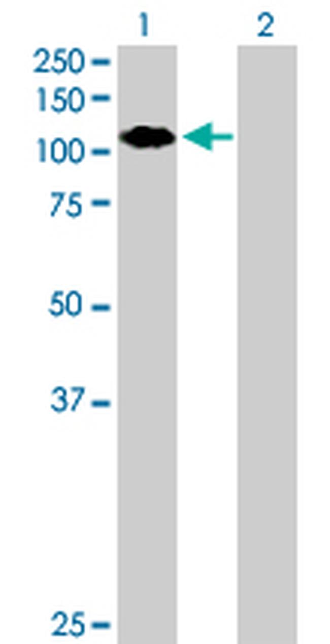 ZNF408 Antibody in Western Blot (WB)