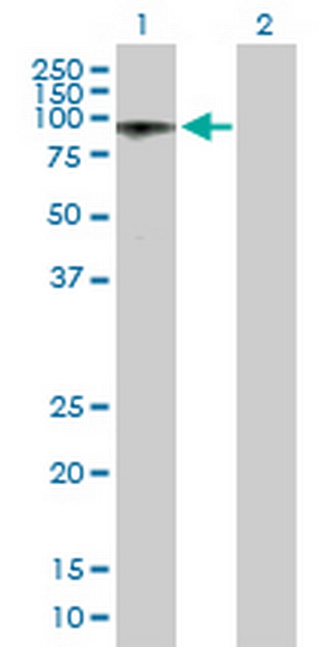 ALS2CR8 Antibody in Western Blot (WB)