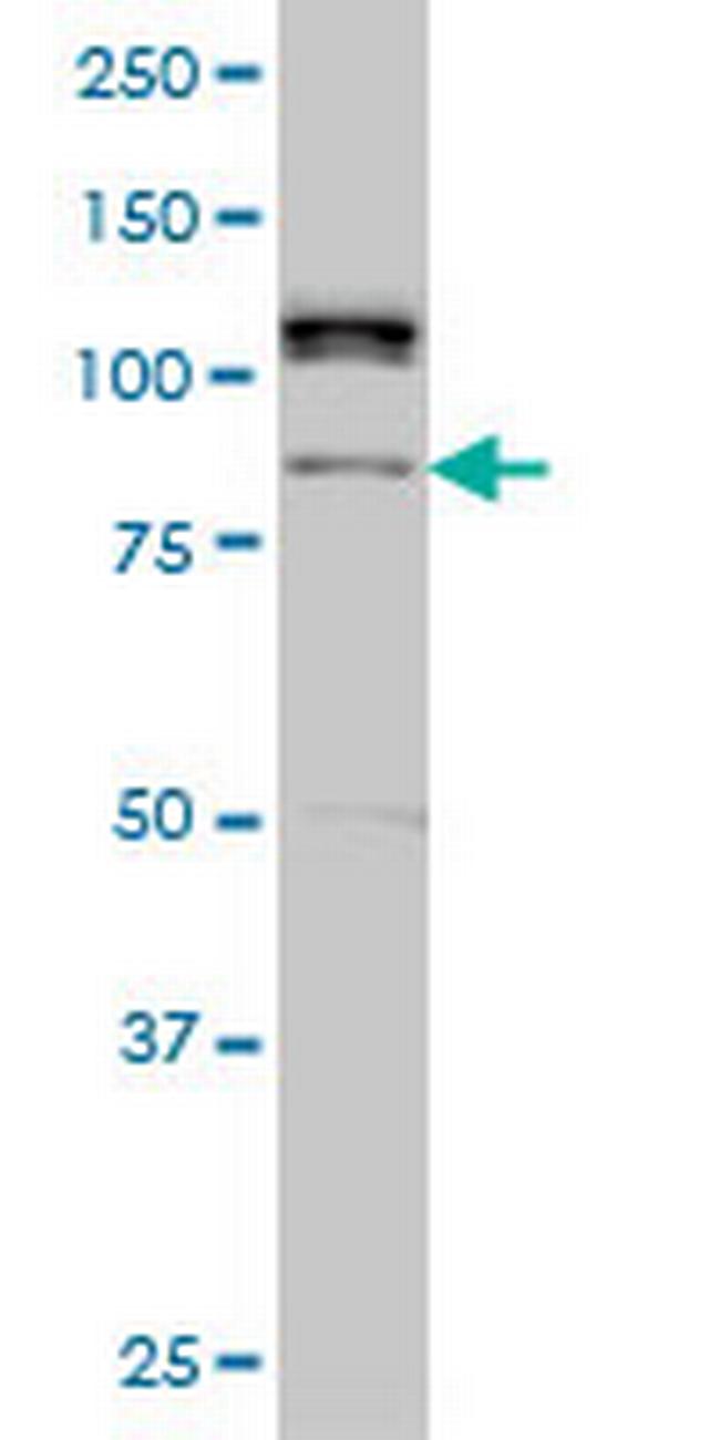 ALS2CR8 Antibody in Western Blot (WB)
