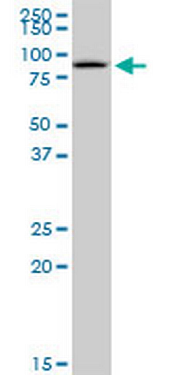 GSTCD Antibody in Western Blot (WB)