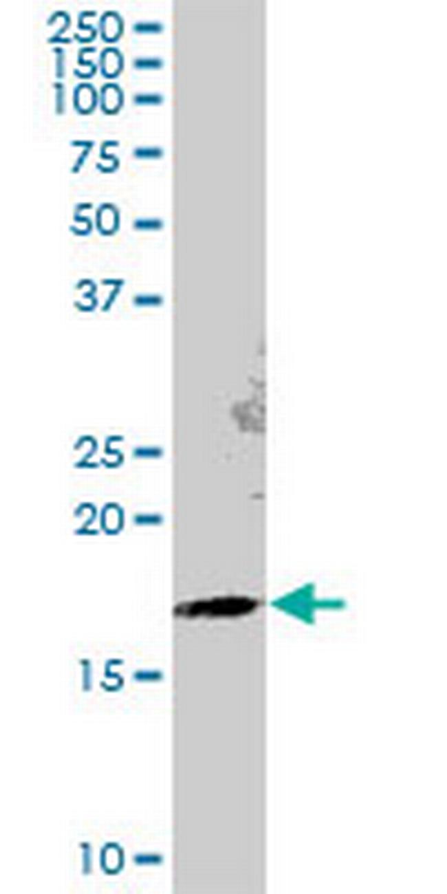 GEMIN6 Antibody in Western Blot (WB)
