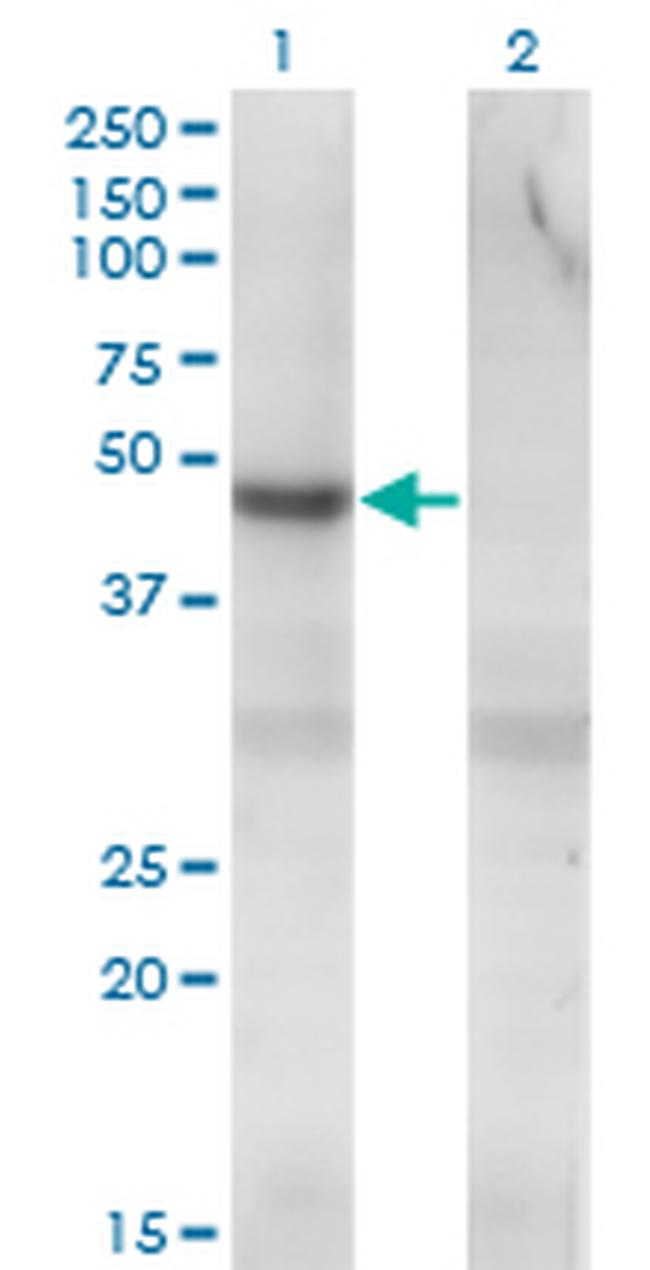 PIP4K2C Antibody in Western Blot (WB)