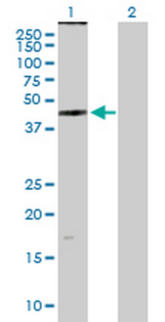 ZDHHC11 Antibody in Western Blot (WB)