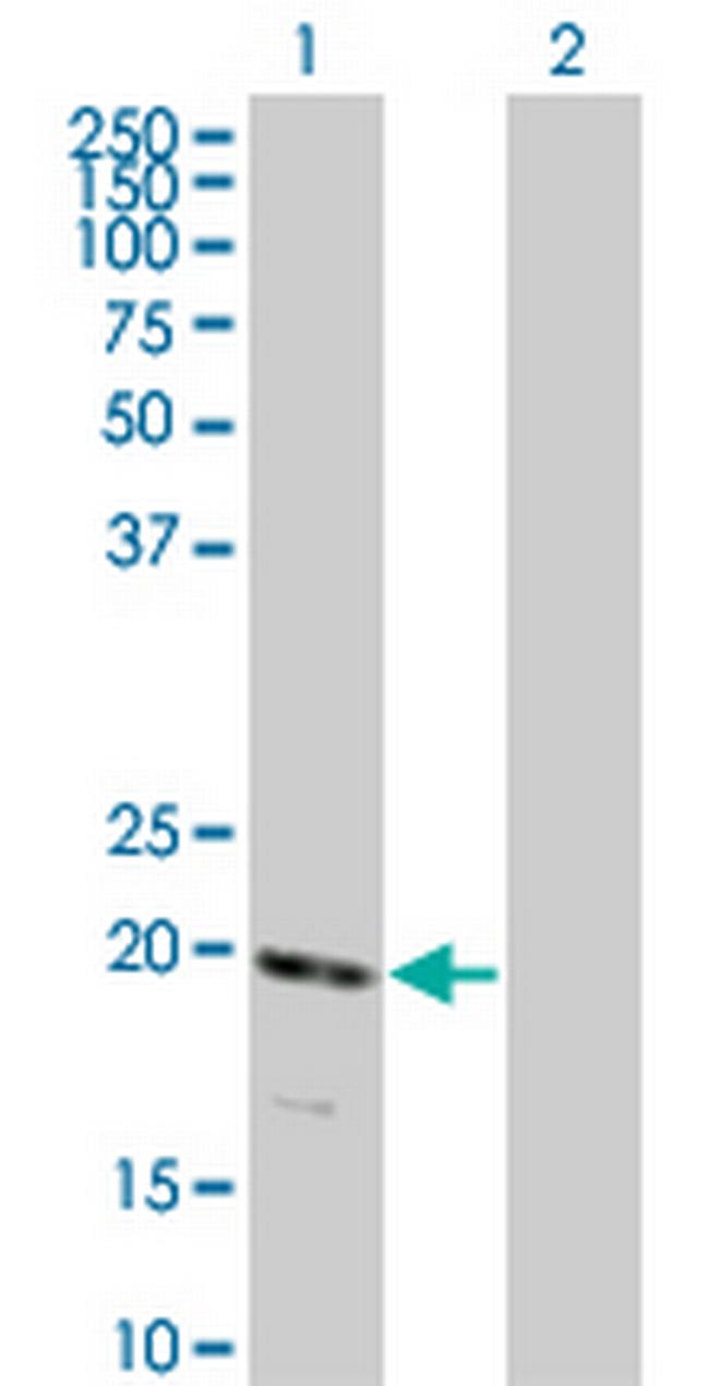RNF122 Antibody in Western Blot (WB)
