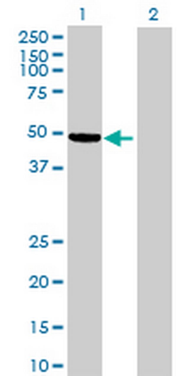 TUBAL3 Antibody in Western Blot (WB)