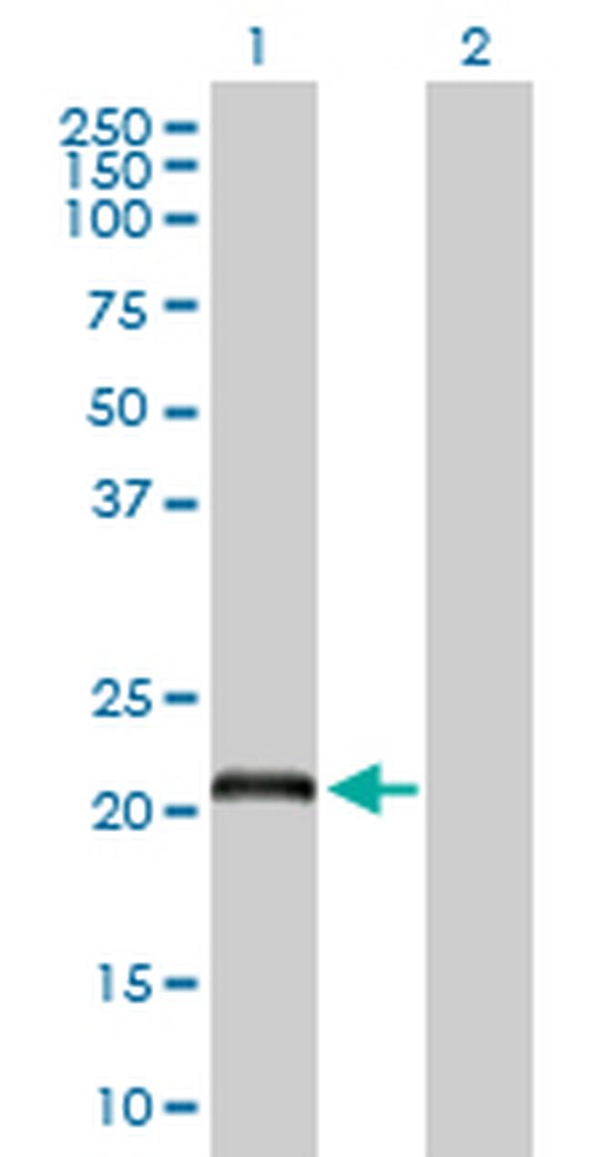DCAKD Antibody in Western Blot (WB)