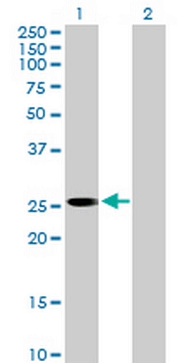 FLJ22662 Antibody in Western Blot (WB)