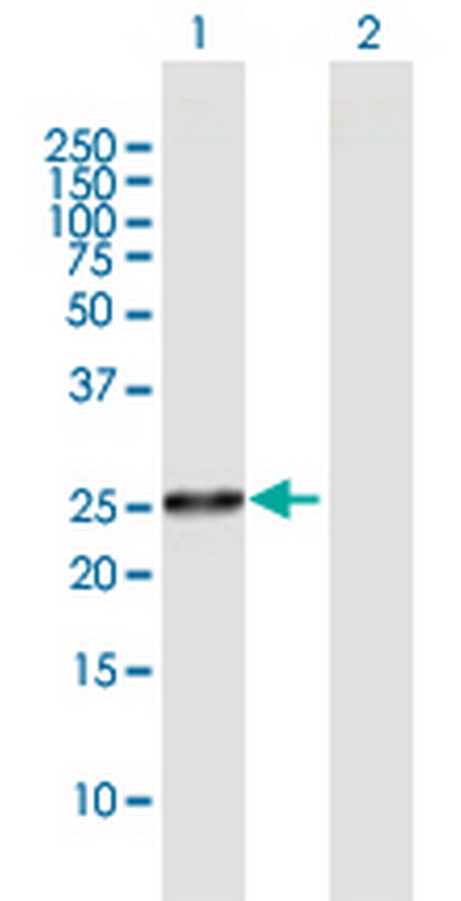 FLJ22662 Antibody in Western Blot (WB)