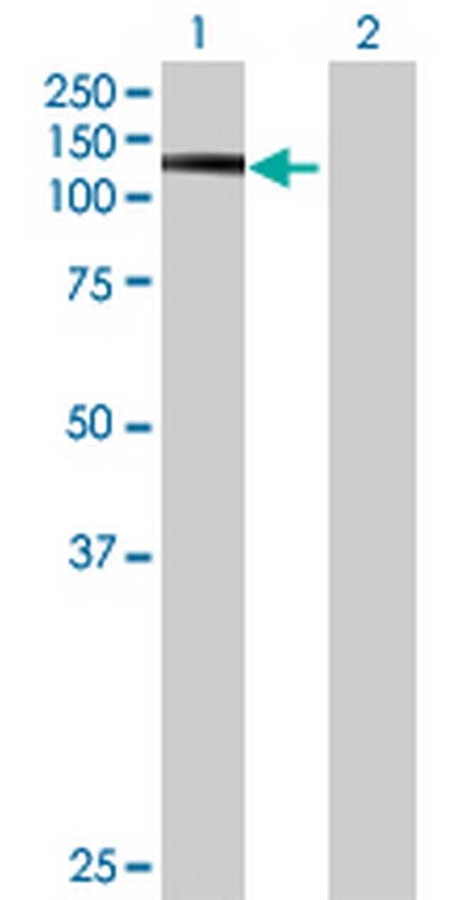 ZNF613 Antibody in Western Blot (WB)