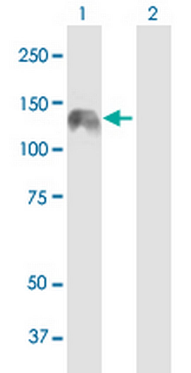 KIAA0319L Antibody in Western Blot (WB)