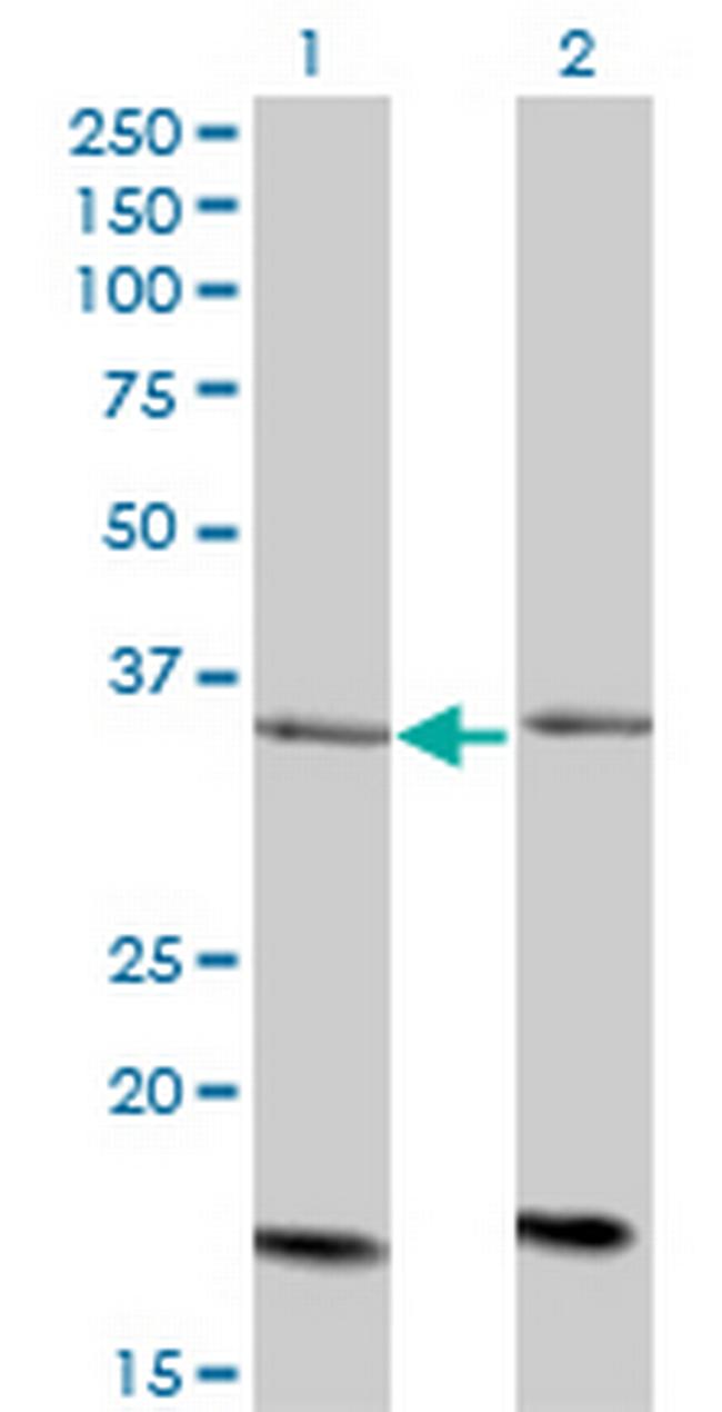 ADCK4 Antibody in Western Blot (WB)