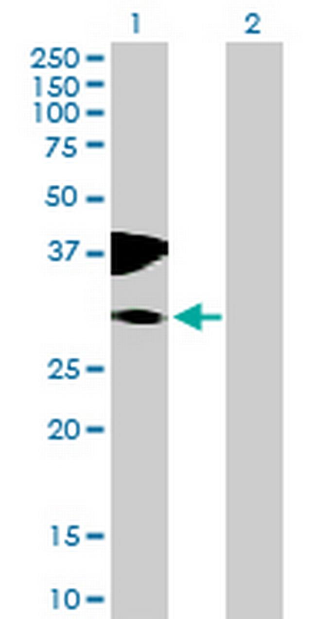 C10orf81 Antibody in Western Blot (WB)