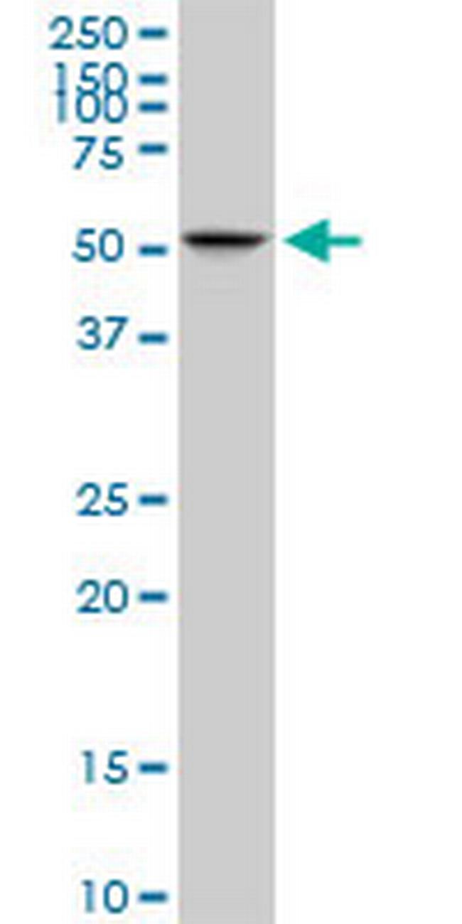 C10orf81 Antibody in Western Blot (WB)