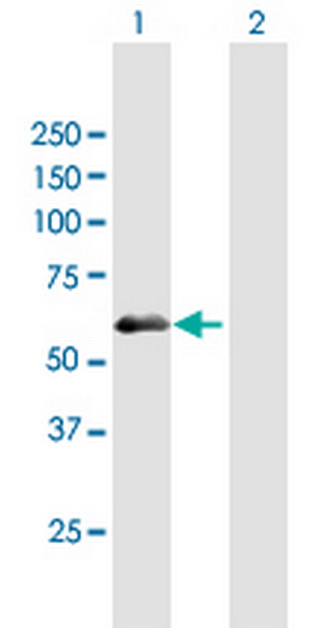 PDZD7 Antibody in Western Blot (WB)
