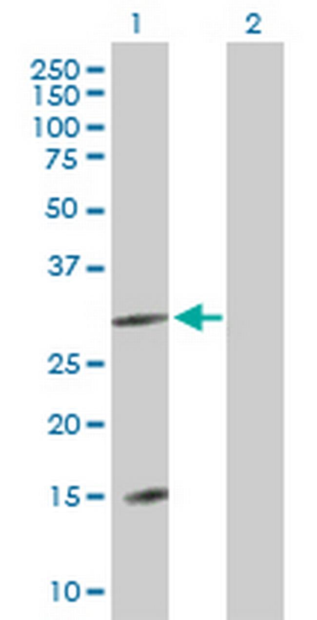 FLJ13236 Antibody in Western Blot (WB)