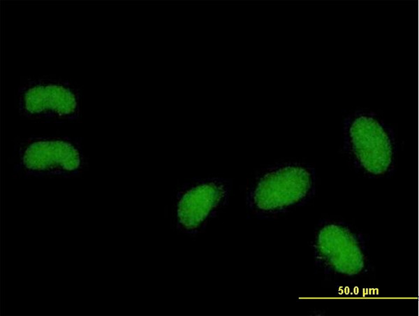 PHC3 Antibody in Immunocytochemistry (ICC/IF)