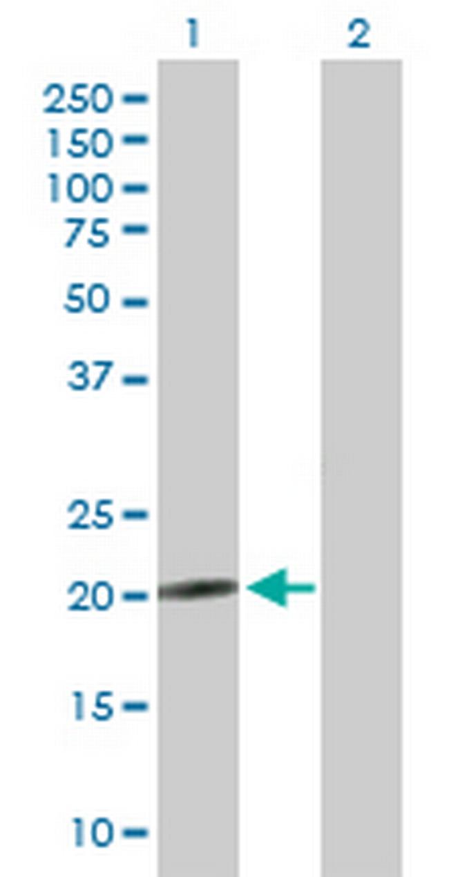 NRSN2 Antibody in Western Blot (WB)