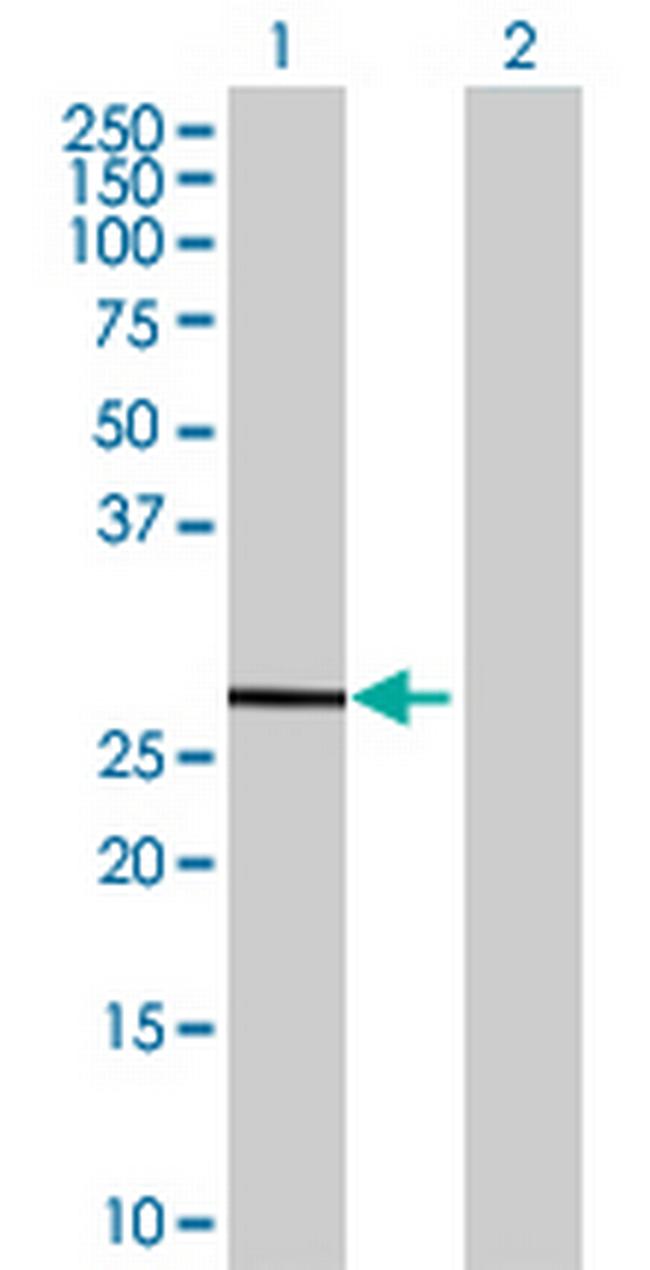 FBXL18 Antibody in Western Blot (WB)