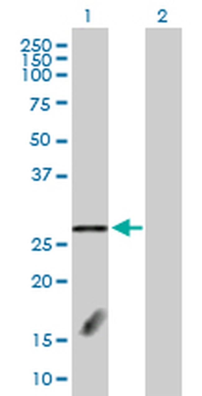 FBXL18 Antibody in Western Blot (WB)