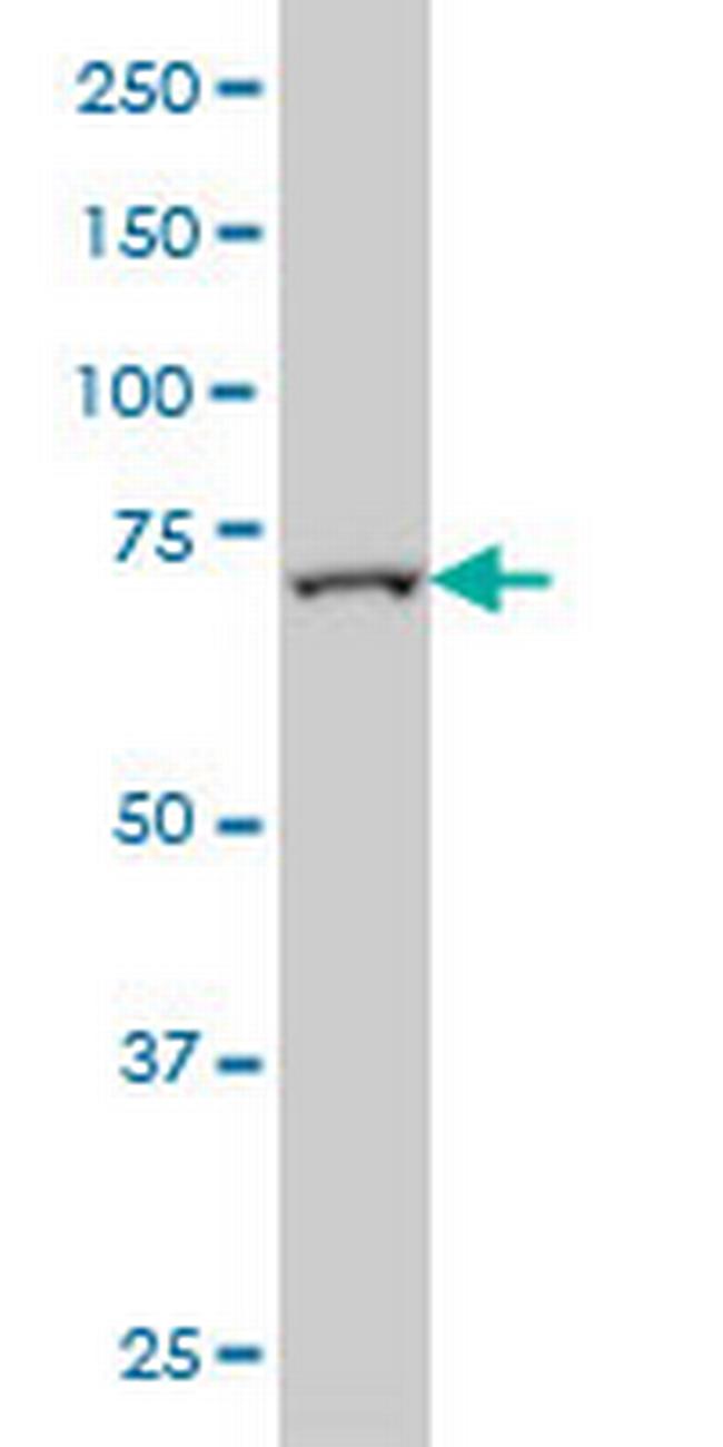 FBXL18 Antibody in Western Blot (WB)