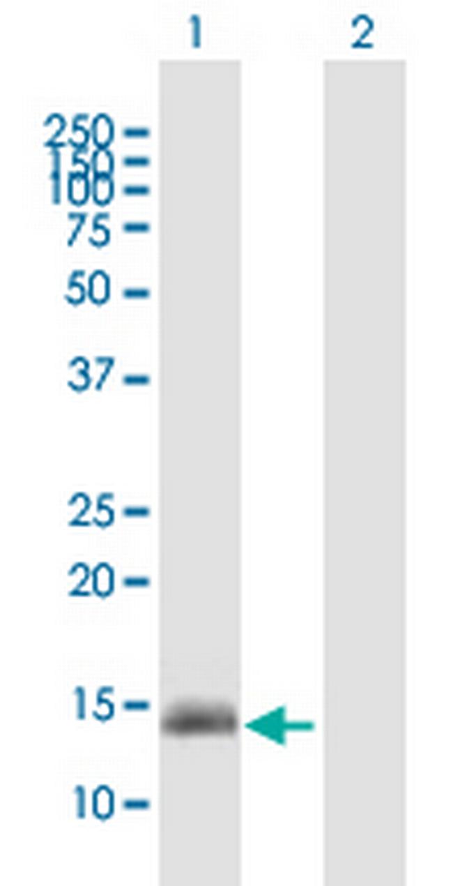 GPR157 Antibody in Western Blot (WB)