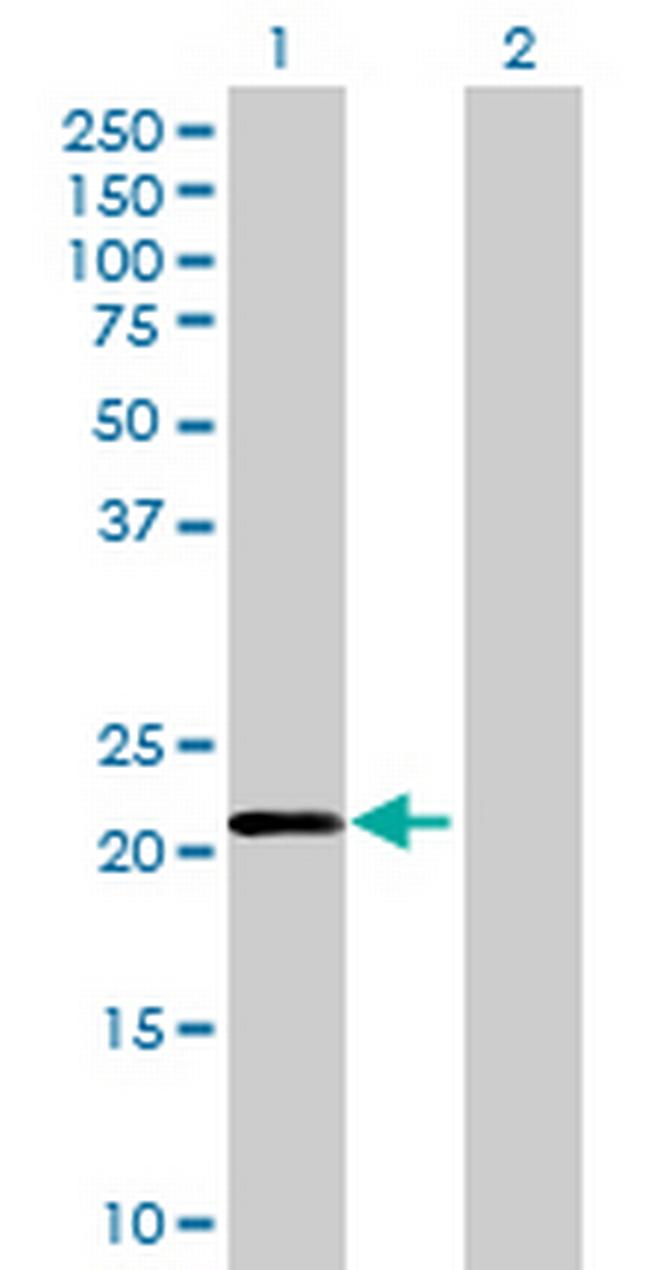 ZNF614 Antibody in Western Blot (WB)