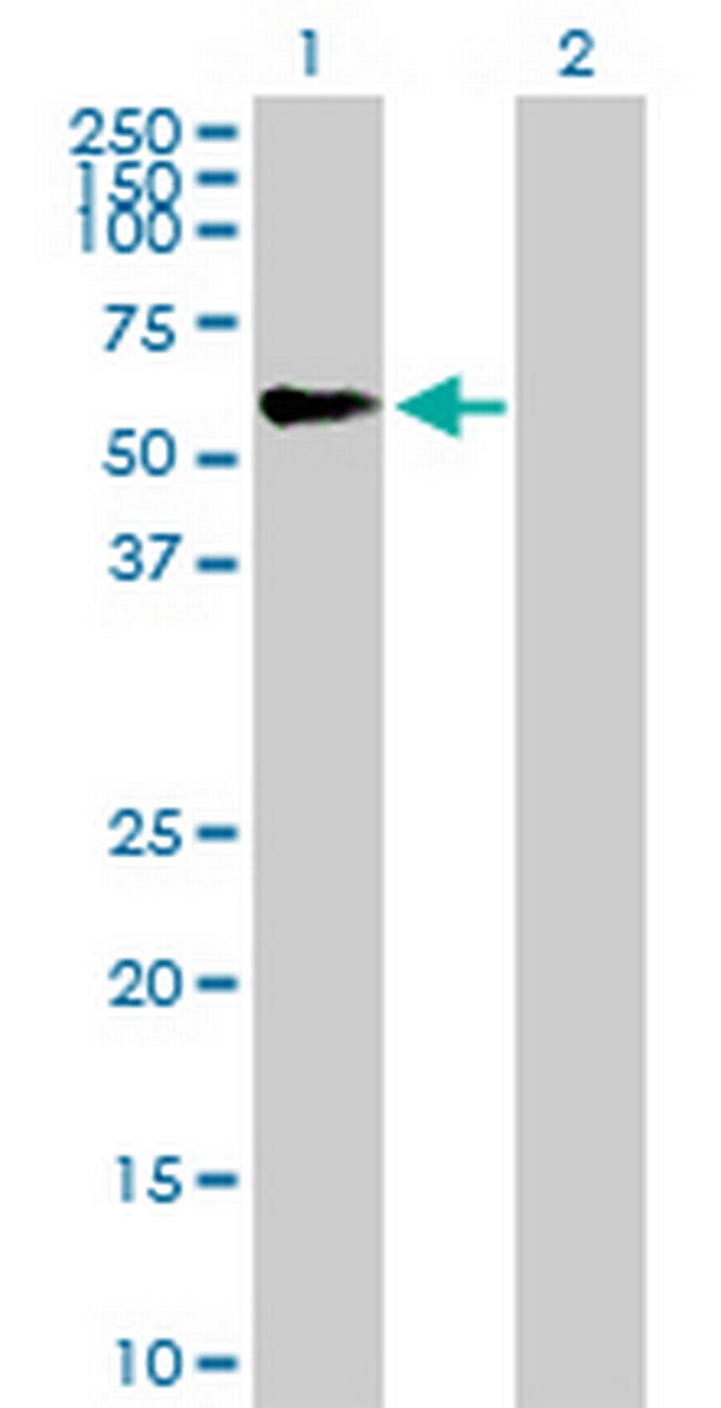 TRIM46 Antibody in Western Blot (WB)