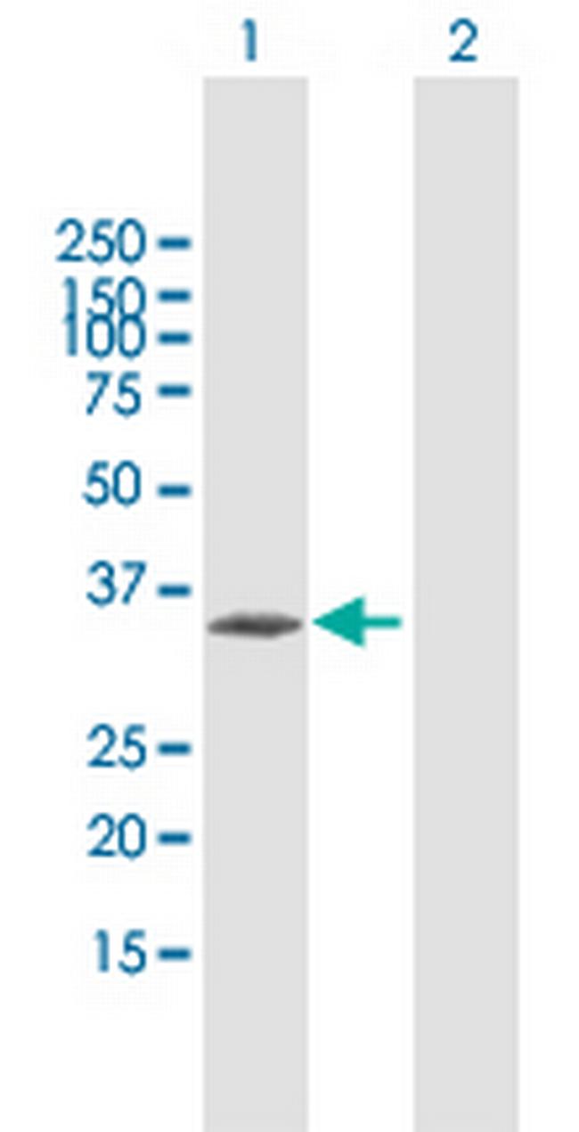CENPT Antibody in Western Blot (WB)