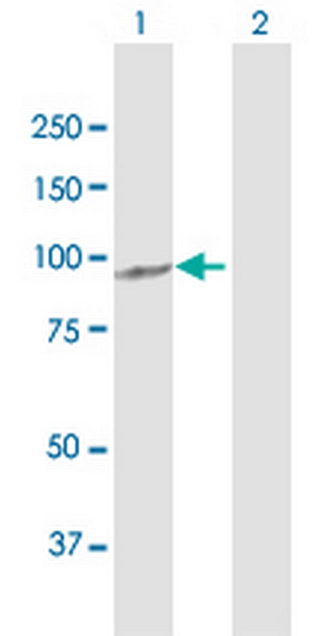 FBXO11 Antibody in Western Blot (WB)