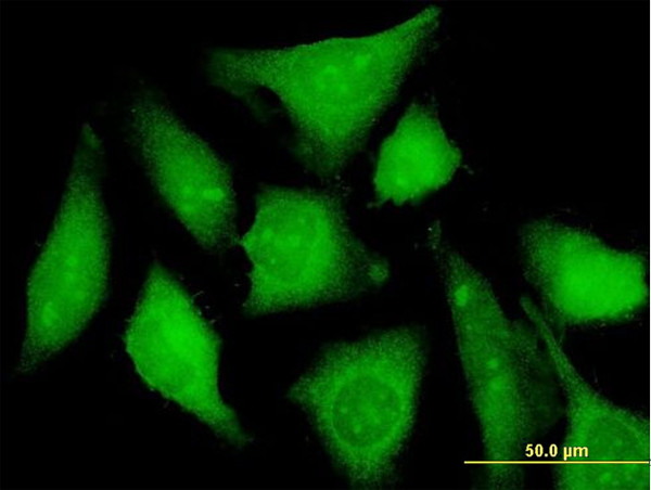 CXORF21 Antibody in Immunocytochemistry (ICC/IF)