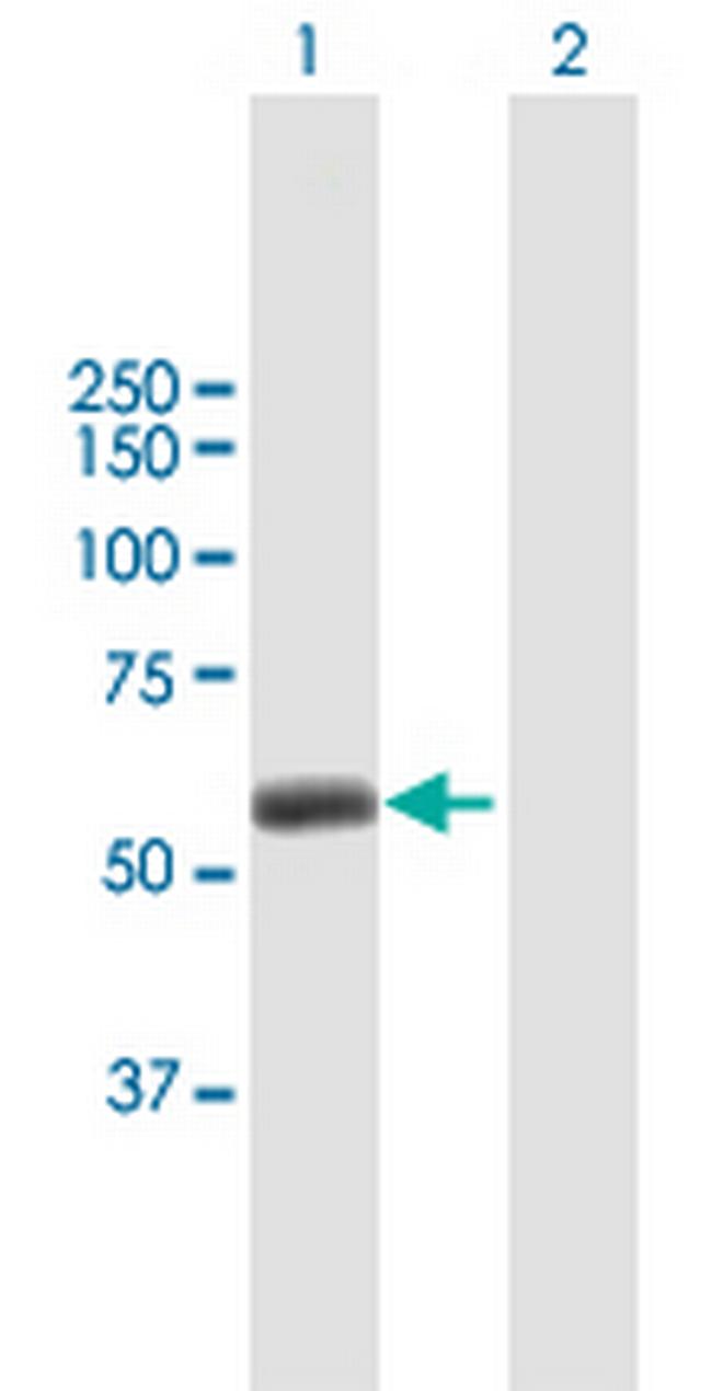 TRIM45 Antibody in Western Blot (WB)