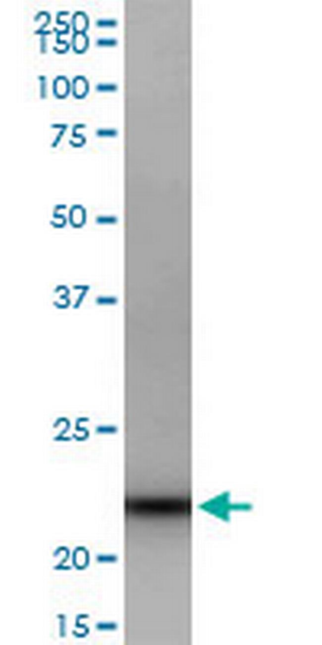 GRPEL1 Antibody in Western Blot (WB)