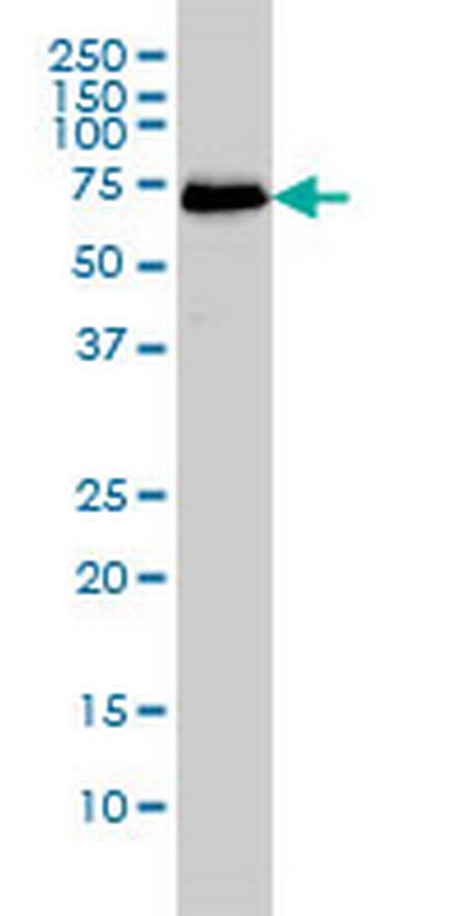 CDK5RAP3 Antibody in Western Blot (WB)