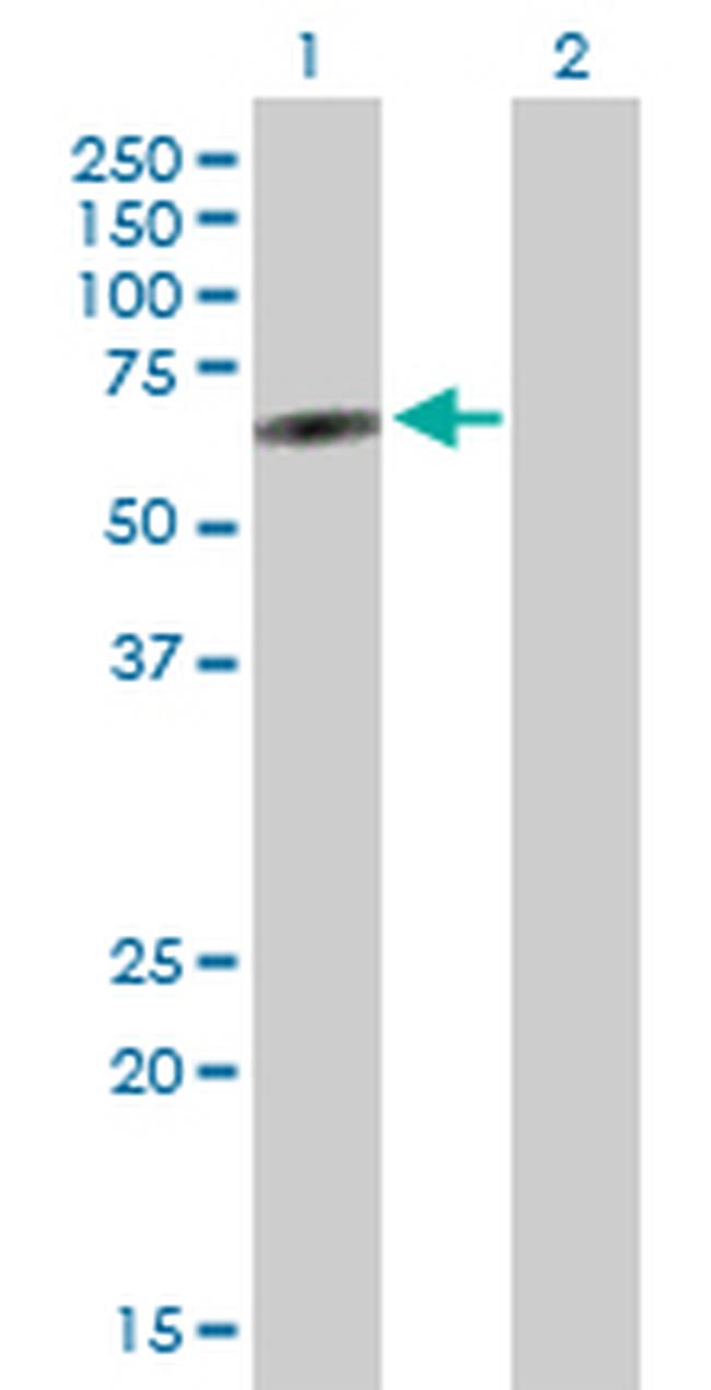 PLEKHO2 Antibody in Western Blot (WB)