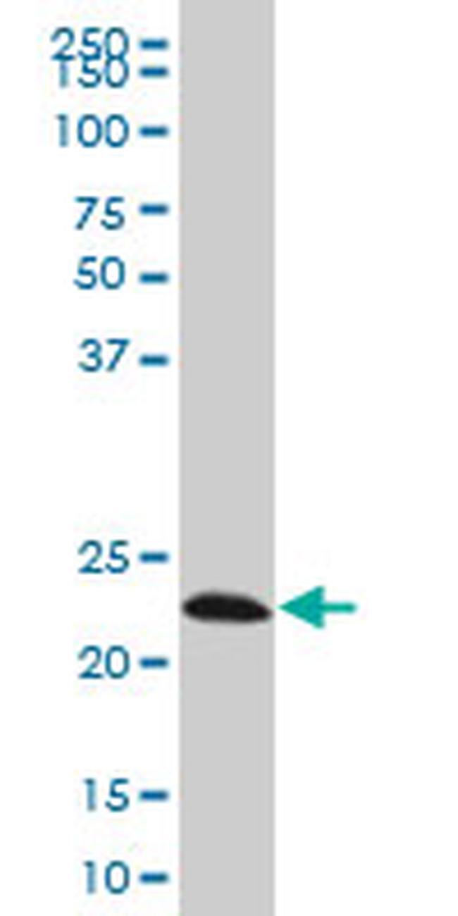 EFHD1 Antibody in Western Blot (WB)