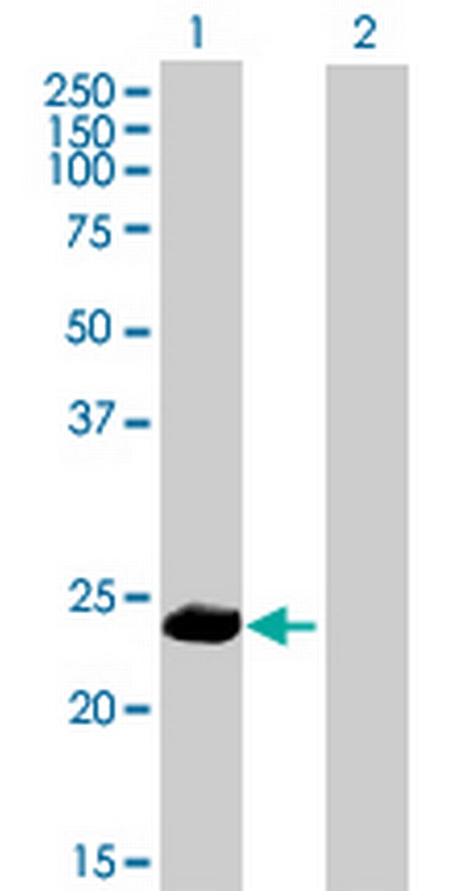 PPP1R2P9 Antibody in Western Blot (WB)