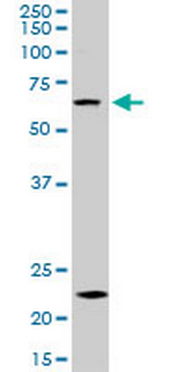 ZKSCAN3 Antibody in Western Blot (WB)
